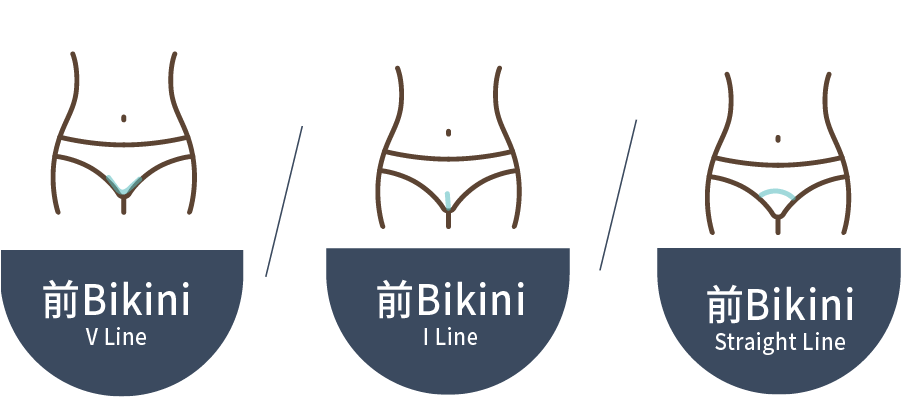 前Bikini V line，前Bikini I line，前Bikini Straight line