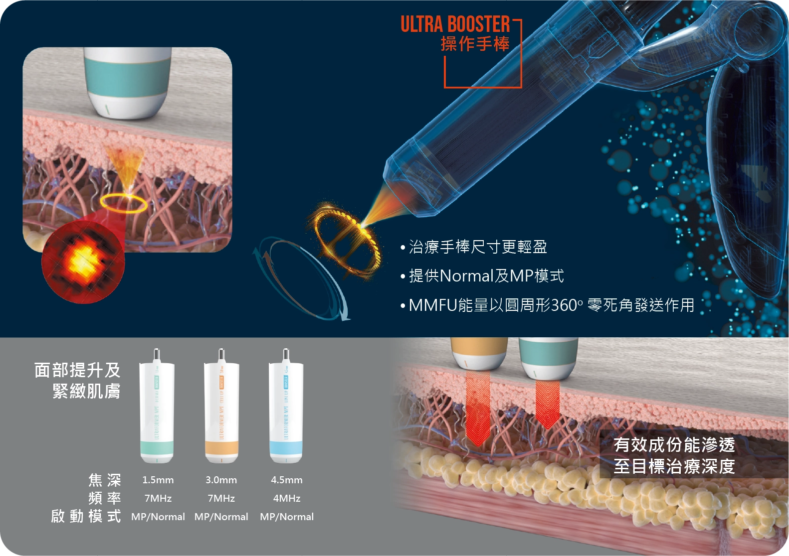 治療手棒尺寸更輕盈 提供Normal及MP模式 MMFU能量以圓周形360o 零死角發送作用4.5mm 4MHz MP/Normal3.0mm 7MHz MP/Normal1.5mm 7MHz MP/Normal焦 深 頻 率 啟 動 模 式有效成份能滲透 至目標治療深度面部提升及 緊緻肌膚操作手棒ULTRA BOOSTER