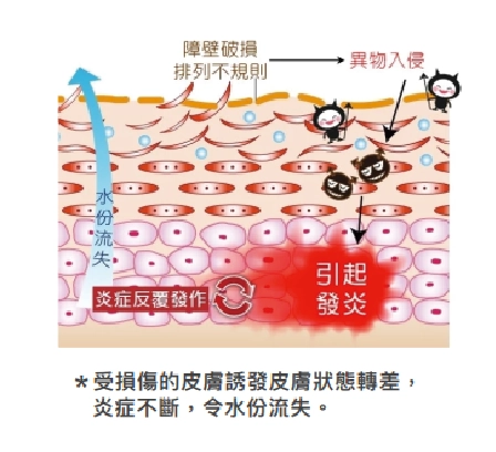 *受損傷的皮膚誘發皮膚狀態𨍭差 炎症不斷,令水份流失